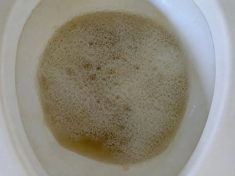 2. Notas espuma en la orina que tarda en desaparecer