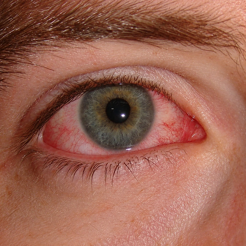 1. Ardor, ojos rojos y sensación de arena: 3 señales que no son solo vista cansada